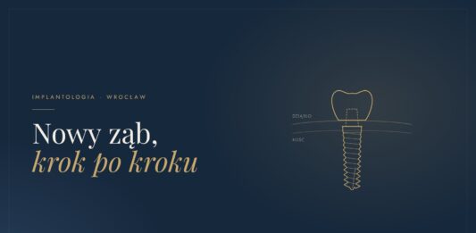 Implant zęba krok po kroku. Jak wygląda leczenie, zanim pojawi się nowy ząb alt: Implant zęba z koroną – ilustracja etapów leczenia implantologicznego